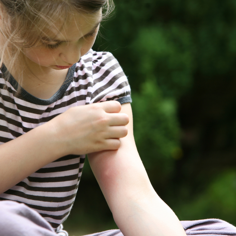Your Oasis Outdoor Care Why Mosquitoes Bite You More Than Others Clermont Florida